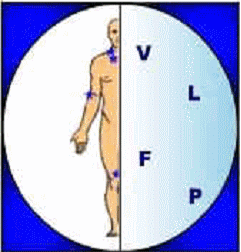 VLFP: Vlaamse liga voor fibromyalgie patienten